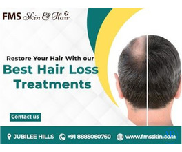 Hair Loss Treatment in Hyderabad - FMS skin &amp; hair clinic