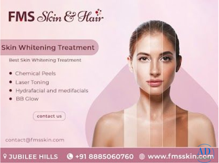 Skin whitening Treatment in Hyderabad