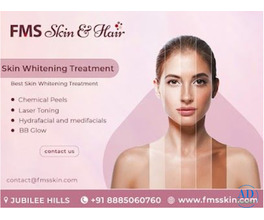 Skin whitening Treatment in Hyderabad