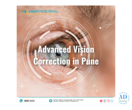 Trusted Eye Care by Experts