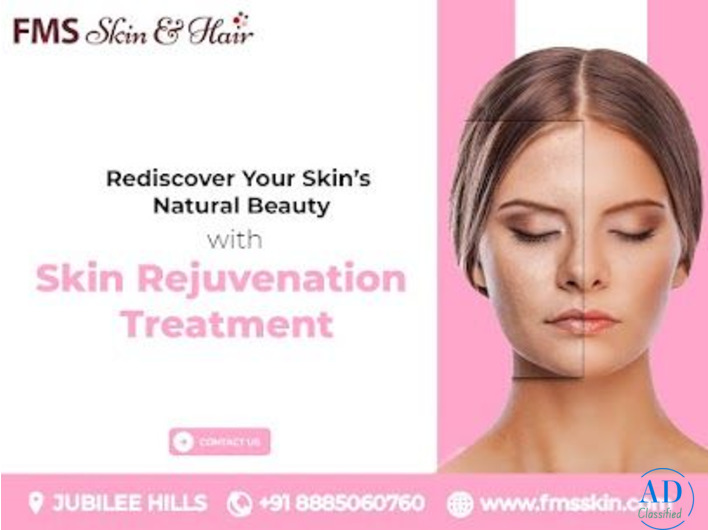Skin Rejuvenation Treatments in Hyderabad - FMS skin & Hair Clinic