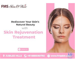 Skin Rejuvenation Treatments in Hyderabad - FMS skin &amp; Hair Clinic