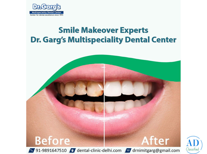Smile Makeover Experts | Dr. Garg’s Multispeciality Dental Center