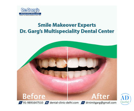 Smile Makeover Experts | Dr. Garg’s Multispeciality Dental Center