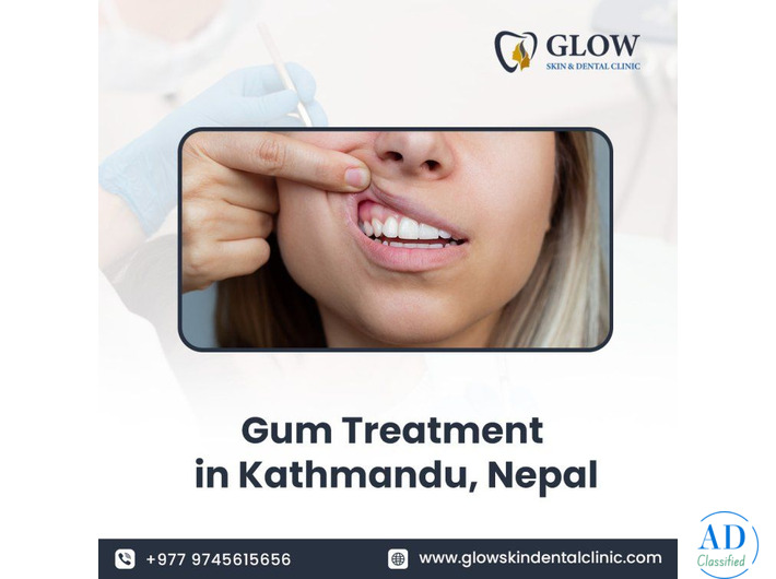 Gum Treatment in Kathmandu, Nepal