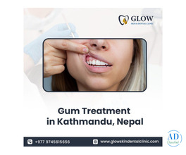 Gum Treatment in Kathmandu, Nepal