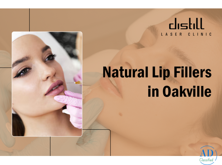 Lip Fillers Oakville | Natural, Plump & Beautiful Lips