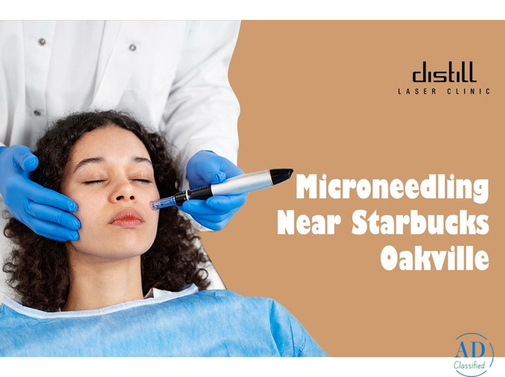 Lip Fillers Oakville | Natural, Plump & Beautiful Lips