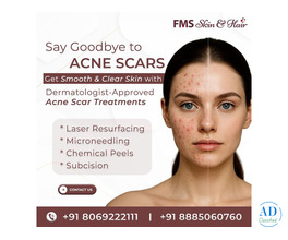 Best Acne Scar Treatment in Hyderabad - FMS Skin & Hair