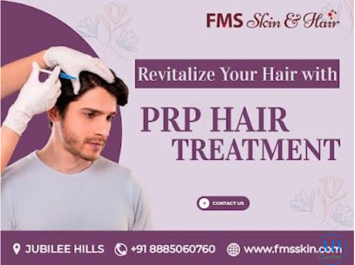 Best PRP Treatment in Hyderabad for Hair Loss