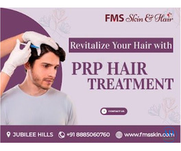 Best PRP Treatment in Hyderabad for Hair Loss