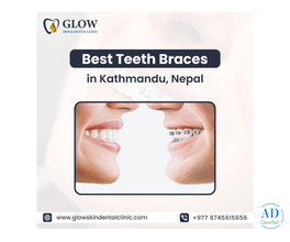 Best Teeth Braces in Kathmandu, Nepal