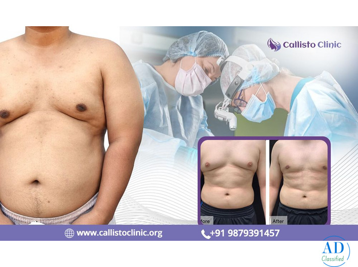 Expert Gynecomastia Surgeon in Surat - Callisto Clinic
