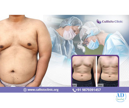 Expert Gynecomastia Surgeon in Surat - Callisto Clinic