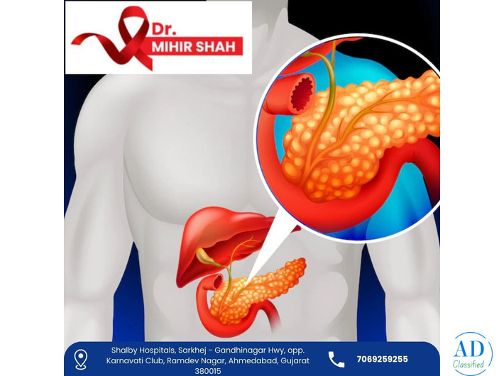 Advanced Pancreatic Cancer Treatment in Ahmedabad – Dr. Mihir Shah