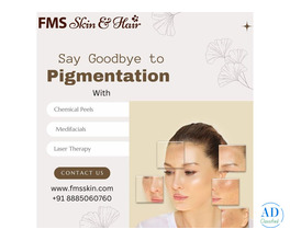 Best Pigmentation Treatment in Hyderabad