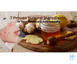 7 Proven Natural Ingredients to Treat Pimples and Acne Naturally