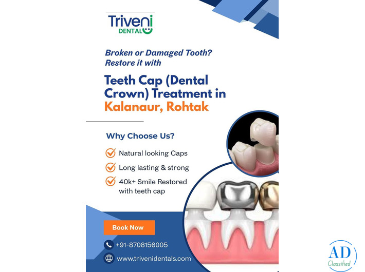Teeth Cap Treatment in Kalanaur, Rohtak | Triveni Dental