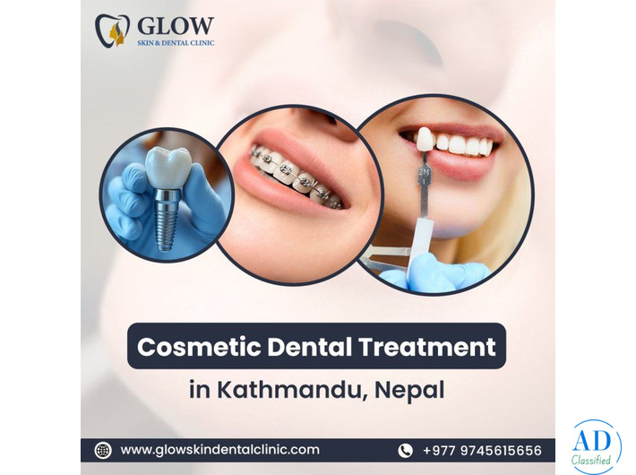 Cosmetic Dental Treatment in Kathmandu, Nepal