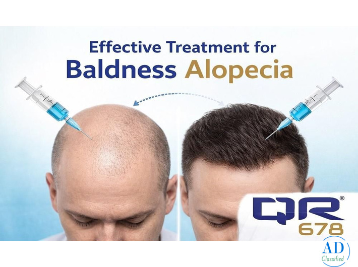 Advanced Baldness Alopecia Treatment with QR678 Therapy