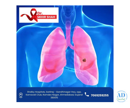 Best Lung Cancer Treatment in Ahmedabad – Dr. Mihir Shah