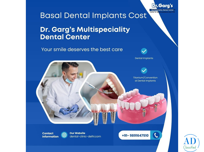 Know Basal Dental Implants Cost at Dr. Garg’s Multispeciality Dental Center