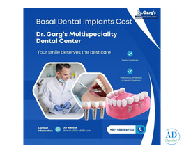 Know Basal Dental Implants Cost at Dr. Garg’s Multispeciality Dental Center