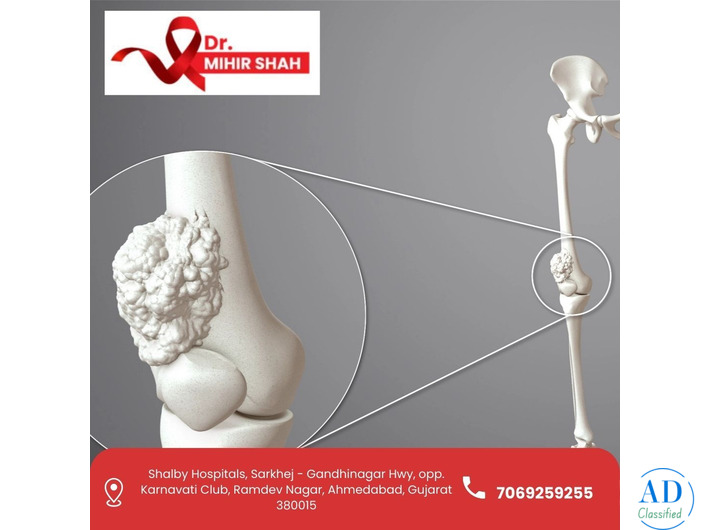 Best Soft Tissue Sarcoma Cancer Treatment – Dr. Mihir Shah