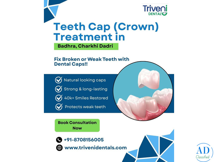 Teeth Cap (Crown) Treatment in Badhra | Triveni Dental