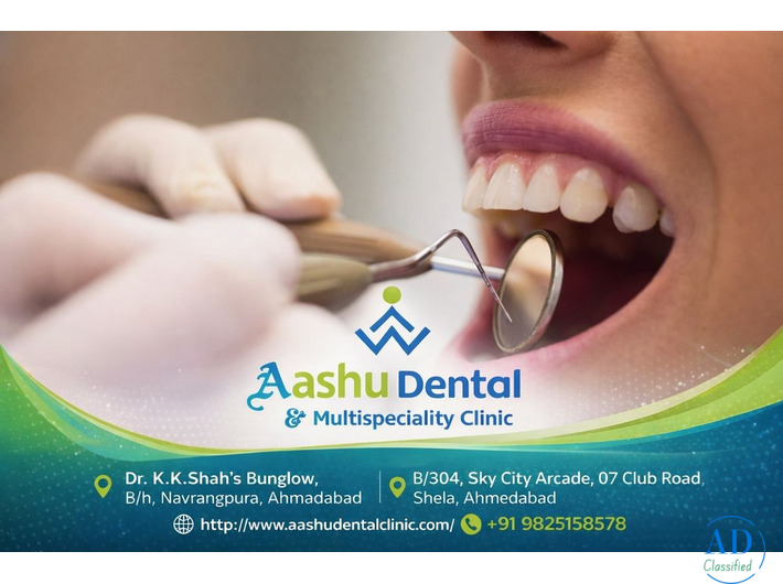 Crowns and Veneers Treatment in Gujarat – Dr. Manish Shah