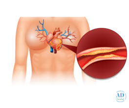 CT Coronary Angiography Price – Cost, Procedure & Benefits Explained