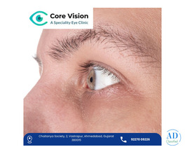 Core Vision Eye – Top  Keratoconus Treatment in Ahmedabad