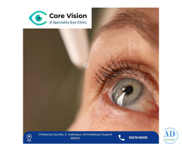 Best Hospital for Corneal Transplant in Ahmedabad - Expert Care Core Vision Eye