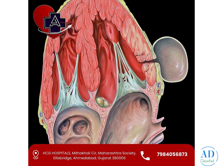 Left Ventricular Aneurysm Treatment in Ahmedabad | Dr. Abhishek Parmar