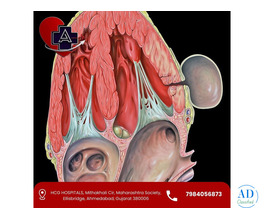 Left Ventricular Aneurysm Treatment in Ahmedabad | Dr. Abhishek Parmar