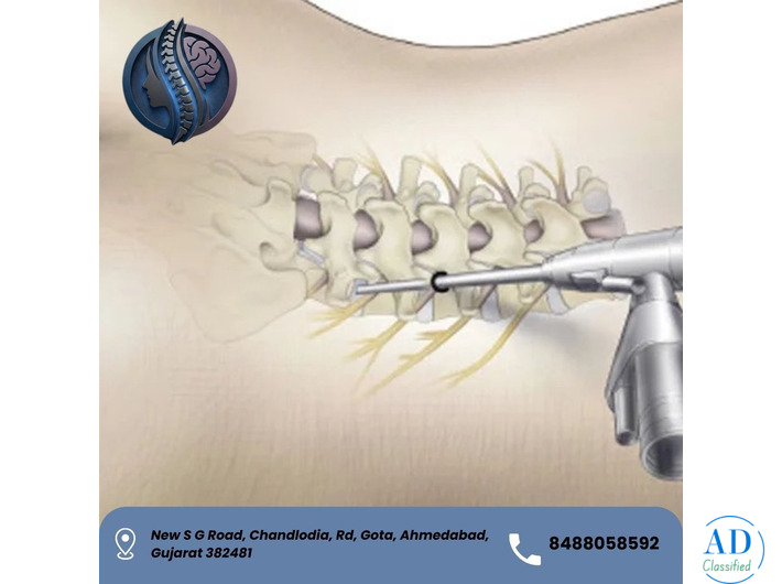 Best Endoscopic Spine Surgery in Ahmedabad – Dr. Deep Parmar