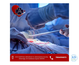 Best Vascular Surgery in Ahmedabad – Dr. Abhishek Parmar