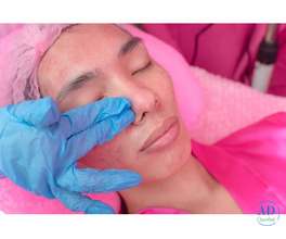 Effective Double Chin Treatment &amp; Skin Tightening Solutions in Dubai