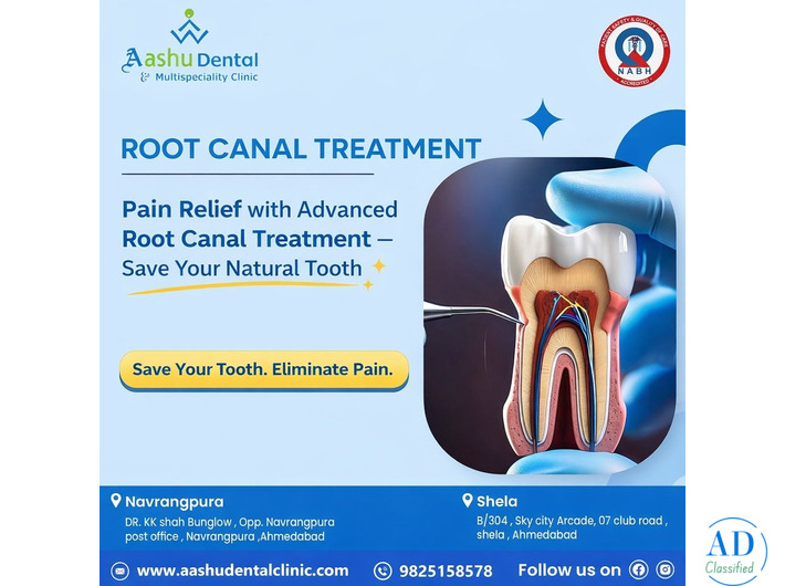 India’s Leading Root Canal Treatment with High Success Rate