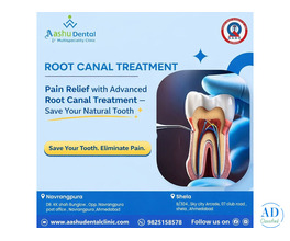 India’s Leading Root Canal Treatment with High Success Rate
