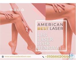 Leg Laser Hair Removal Austin, Texas | Smooth, Hair-Free Legs