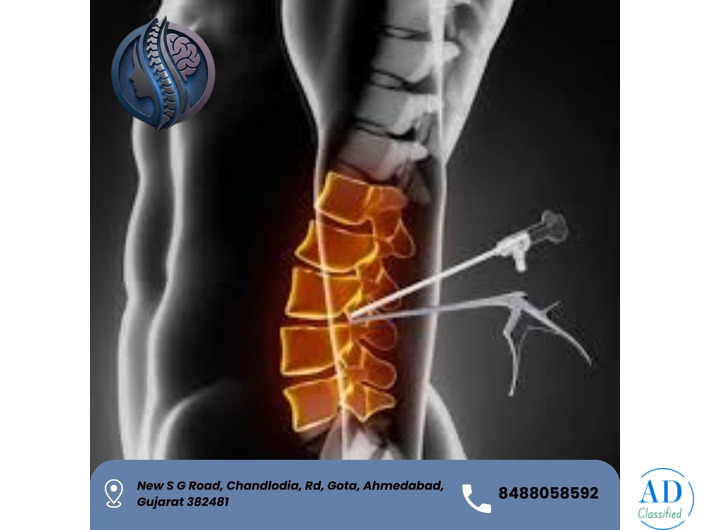 Top UBE Spine Surgery in Ahmedabad - Dr. Deep Parmar