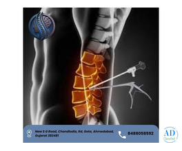 Top UBE Spine Surgery in Ahmedabad - Dr. Deep Parmar