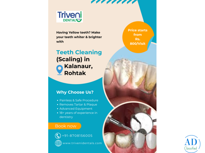 Teeth Cleaning in Kalanaur, Rohtak | Triveni Dental