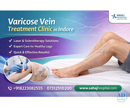Varicose Vein Treatment Clinic in Indore – Sahaj Hospital