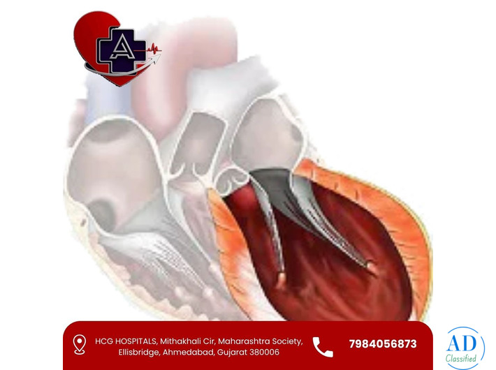 Dr. Abhishek Parmar – Left Ventricular Aneurysm Treatment in Ahmedabad