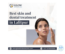 Best Skin and Dental Treatment in Lalitpur