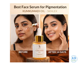 Best Face Serum for Pigmentation ( Kumkumadi oil ) - Sknlex