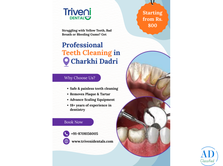 Best Teeth Cleaning (Scaling) in Charkhi Dadri | Triveni Dental