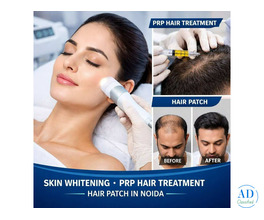 Best Skin Whitening Treatment in Noida | Advanced PRP Hair Treatment &amp; Hair Patch in Noida